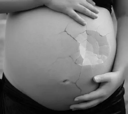 feng shui Inability to Conceive House. female with broken egg as belly